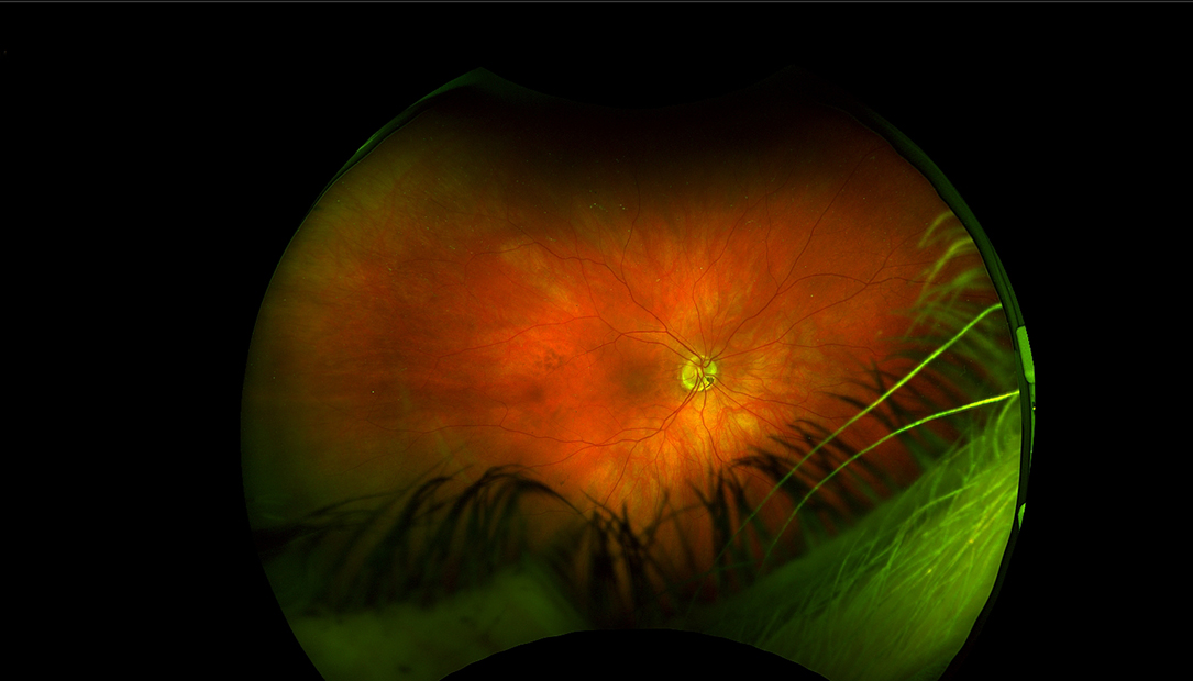 Retina of an eye